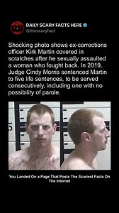 Former corrections officer Kirk Martin was sentenced in 2019 to five consecutive life sentences, one of them without the possibility of parole, after being convicted of sexually assaulting a woman who fought back with everything she had. A photograph taken after the attack shows Martin’s face covered in scratches — clear evidence of the victim’s resistance. Judge Cindy Morris handed down the severe sentence, calling Martin’s actions an egregious abuse of power. The image and the case stand as po