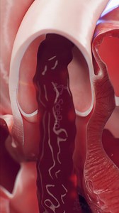 446K views · 4.2K reactions | The pulmonary valve sits between the...