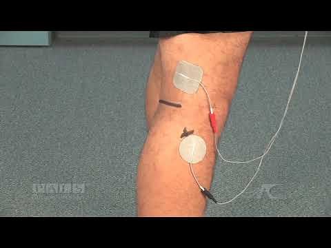 Flexion Reflex (Option 1) Electrode Placement for Muscle Stimulation