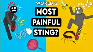 Discover the most painful sting that humans can still survive