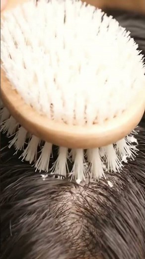 ⚠️ Don’t Watch If You Need to Stay Awake | ASMR Macro Scalp Scratching & Dandruff Removal