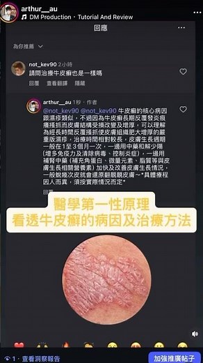 醫學第一性原理看透牛皮癬的病因及治療方法 #中醫 #健康 #養生 #進步 #牛皮癬 #濕疹