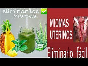 Elimina los miomas con 3 ingredientes ✔ facil