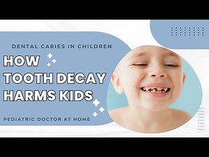 The Impact of TOOTH DECAY in Kids | Dental Caries PREVENTION
