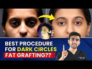 Dark Circle Kaise Hataye in 2025: Use Your Own FAT as Fillers | Remove Under Eye Circles Permanently