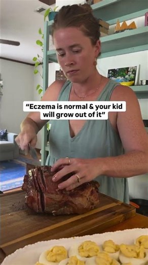 Babies have allergies and eczema and doctors tell moms there is nothing you can do