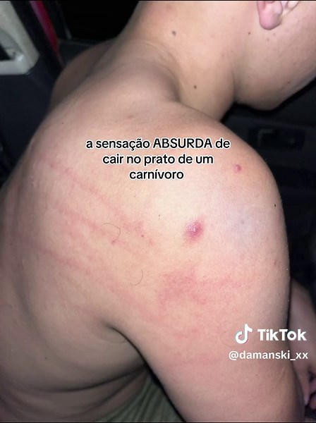 A Sensação de Cair no Prato do Carnívoro