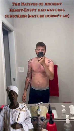 Hey, “We Wuz” army. Please explain this. He goes to Egypt and gets sever sunburns after no sunscreen for 1 day. Do you want to know the last time I put sun screen on? Or the last time I avoided the sun? I actually prefer to sit under the sun. Makes me feel better
