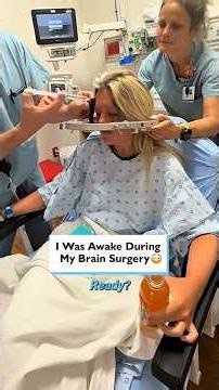 Being awake for brain surgery is WILD 🧠😱 #BrainSurgery #Dystonia #MedicalStorytime #RealLifeStories