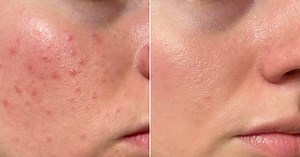 Ce sérum Garancia combine anti-imperfection et anti-âge en un seul geste