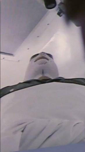 ZAP-X Radiation Therapy: Revolutionizing Brain Care