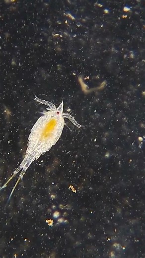 Join Me on a Trip To My Local Lake! #microscope #microscopemagic #microworlds #newchannel