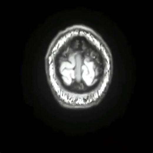 🤯 ROBOTIC SPINE SURGERY 🤯 👀 We pushed our engineering to an unmatched level of precision, making our simulation technologies fully compatible with any robotic surgery system. Robotic-assisted surgery, in numbers: •⁠ ⁠40% greater surgical accuracy •⁠ ⁠30% fewer errors •⁠ ⁠25% faster procedure times Full procedures. Simulated EVERYWHERE. Safe. ✅ Repeatable. ✅ It’s human skill amplified by tech you can trust. And in the end? You own every millimeter.⚡ 👉🏻 upsurgeon.com/technologies 👉🏻 For Dat