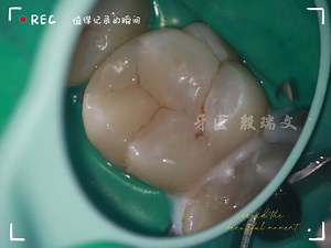 你以为是个“小洞”，其实是个“大坑”