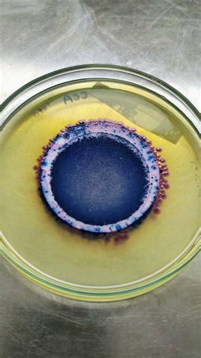 Membrane filtration (MFT) microbiological analysis of a water sample.