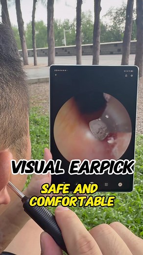 #earwaxremovaltool #visualearpick #earwaxcleaning #earclean #itch