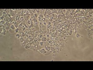 Biofilm in the Mouth