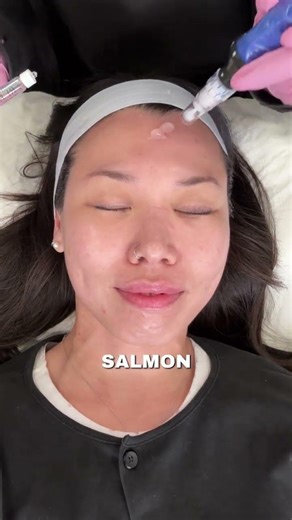 SkinPen Microneedling + Rejuran is our go-to recipe for glass-like skin.
