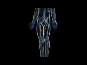 Dorsal Root Ganglion (DRG) Stimulation