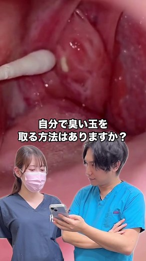 みんなはあるかな？🫢#ほほえみ歯科 #臭い玉 #膿栓