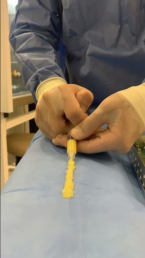 PRP Plasma Gel: Revolução no Tratamento da Dor no Joelho