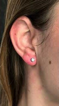 Young Woman Gets Her Ears Re-Pierced With A Needle