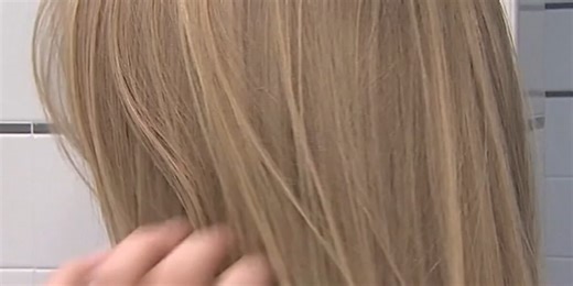 Weight loss drugs and hair loss