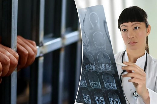 How one hit to the head can knock you into a life of crime: study