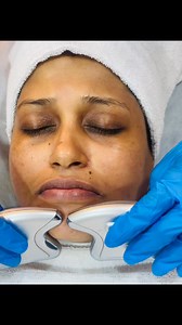 #glassyskin#spotout#superwhitening#glowing যারা স্কিনের বিভিন্ন সমস্যায় ভুগছেন বিভিন্ন সমস্যা দূর করে স্কিনটাকে চকচকে গ্লাসি স্কিন করবে।😍🥰দিন দিন স্কিনটা কালো হয়ে যাচ্ছে? স্কিনে কোনো গ্লো নেই,?স্কিনটা কুচকে যাচ্ছে,?চোখের ওপর নিচে ডার্ক সার্কেল চলে এসেছে,? অনেক পুরনো ট্যান কিছুতেই রিমুভ করতে পারছেন না? পিগমেন্টেশন,মেচেতা, ব্রাউন তিল, অনেক কিছু মেখে স্কিনটাকে পাতলা করে ফেলেছেন?পিম্পেল স্পট, এই সমস্ত সমস্যায় যারা ভুগছেন তারা আর একদম দেরি না করে আমাদের এই প্রোডাক্ট ব্যবহার করবেন । আপনাদের স্কিন