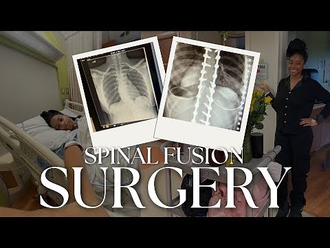 My Scoliosis Spinal Fusion Journey | Hospital Vlog Pt. 1: Surgery Day & Hospital Recovery