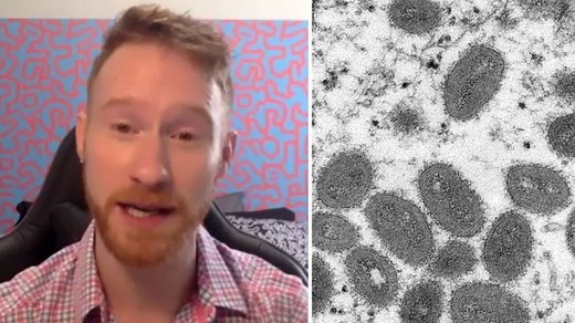 Monkeypox: Everything you need to know about symptoms, spread, treatment and vaccines