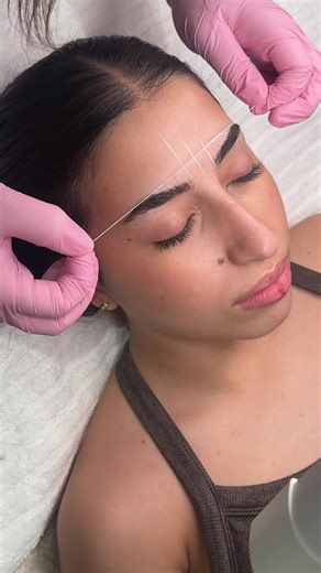 Mapping Brows: Sydney's Laser Hair Removal