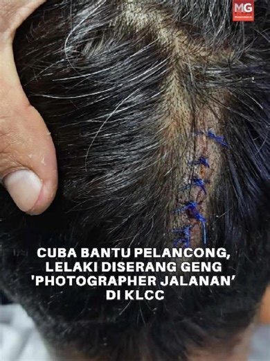 Seorang lelaki cedera selepas diserang sekumpulan individu dalam satu kejadian di hadapan mesin ATM di Jalan P. Ramlee, pada malam 22 Mac lalu. Dalam kejadian kira-kira jam 9 malam itu, mangsa mendakwa melihat seorang pelancong lelaki warga India sedang dipukul oleh sekumpulan lelaki tempatan dipercayai seramai lima orang yang bekerja sebagai jurugambar jalanan di kawasan sekitar KLCC. Situasi bertukar tegang apabila mangsa secara tiba-tiba diserang dari arah belakang dan dipukul di bahagian kep