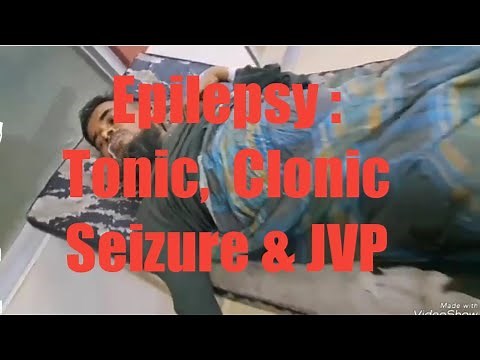 Epilepsy : Types of clonic seizure|Tonic & clonic phase | JVP