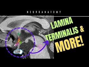 🧠 Lamina Terminalis & Anterior Third Ventricle | Neuroanatomy Simplified! 🧠