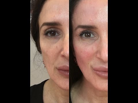 Facelift at home with Microcurrent and Face blaster