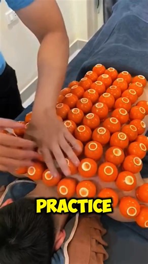 Cupping Therapy EXPLAINED 😨 #CuppingTherapy #AlternativeMedicine #HealthAndWellness #HolisticWellness | Jplay Sts