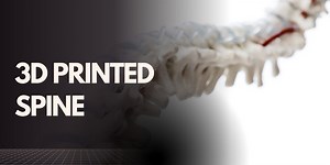 3D printed spine