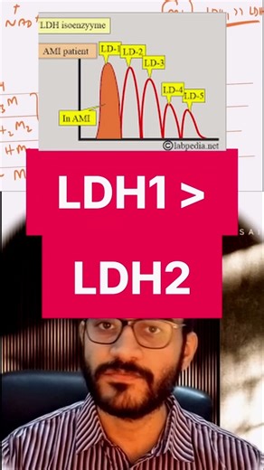 LDH Isoenzymes Explained: The "LDH Flip" in Myocardial Infarction 🫀 #biochemistry #ldh #MI
