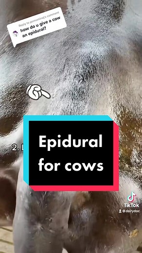 Replying to @pomominaj like this! We just give one injection, so no need for a catheter like in humans. This provides adequate anesthesia to the hind end and is very helpful during tough calvings. #dairy #cow #epidural #calving #labor #laboranddelivery #anesthesia #epiduralspace #anesthesiology #obgyn #obstetrics #lidocaine #veterinarian #humans #animals #pain #painmanagement #dairydoc #dairykind