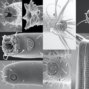 The Microbiome of Nematodes Reveals Their Diversity | Microbiology