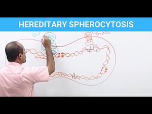 Hereditary Spherocytosis | Diagnosis & Treatment | Genetics👨‍⚕️