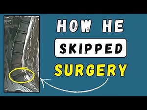 Lumbar Disc Extrusion recovered and skipped surgery