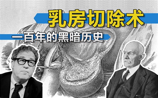 【癌症简史04】最激进的理念，50万人残疾，乳腺癌手术的黑暗往事