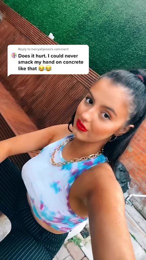 Symbrachydactyly: Embracing Uniqueness with Baby Hand