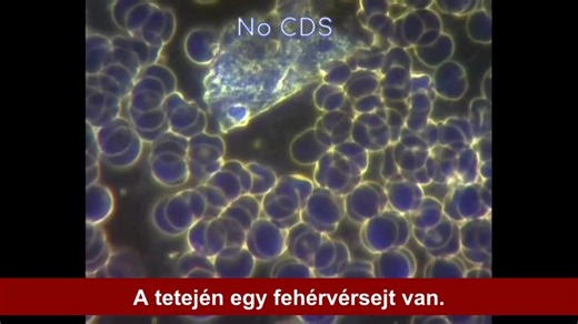 #KLÓRDIOXID# ##CDS# #ÉLŐVÉRELEMZÉS# Élő vérelemzés és klór-dioxid (CDS). Az univerzális ellenszer (klór-dioxid) hatásainak megfigyelése élő vérelemzéssel. (Kíváncsi Outlier - 2025 november 10.) Bevezetés: Az elmúlt években számos figyelemre méltó beszámolót kaptam olyan személyektől, akik élővér-elemzést alkalmaztak a klór-dioxid hatásainak valós idejű megfigyelésére. Ezek az első kézből származó beszámolók a mikroszkóp alatt közvetlenül látható átalakulásokat írják le: a sejtaktivitás, a vérára