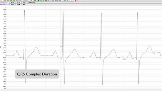 心电图测量系统