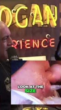 Bot Fly Larvae Extraction: A Gruesome Reality #shorts