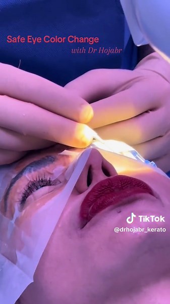 Safe Eye Color Change Techniques with Dr. Hojabr