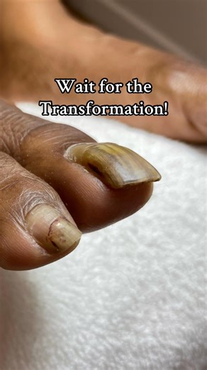 Anyone can learn to clean their nails safely. You’re not alone and deserve comfort, confidence, and health. Kits available meticulousmanicurist.com | The Meticulous Manicurist Nail Tutorials